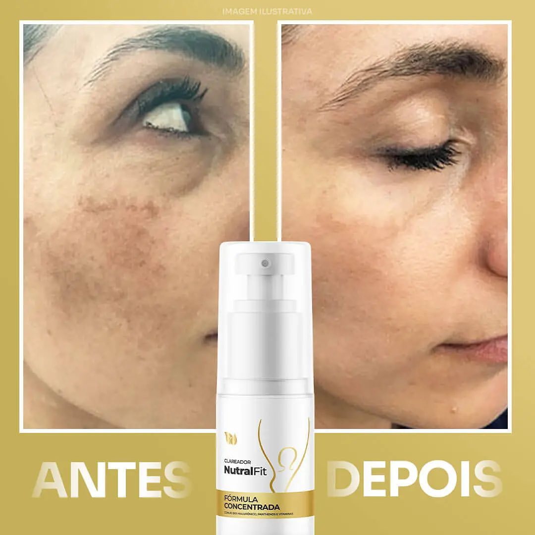 Compre 1 Leve 3 - Clareador Nutral Original  [Tratamento Completo]